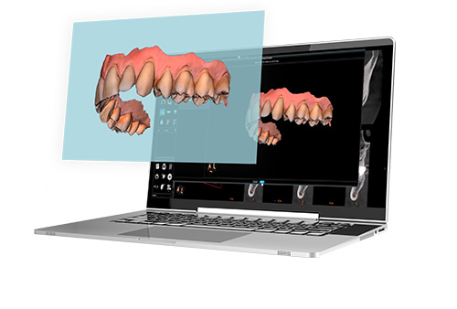 IO Scanner Link